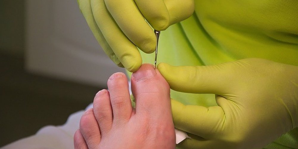 Unlocking a Healthier Life: The Essential Role of Podiatrist and Foot Care