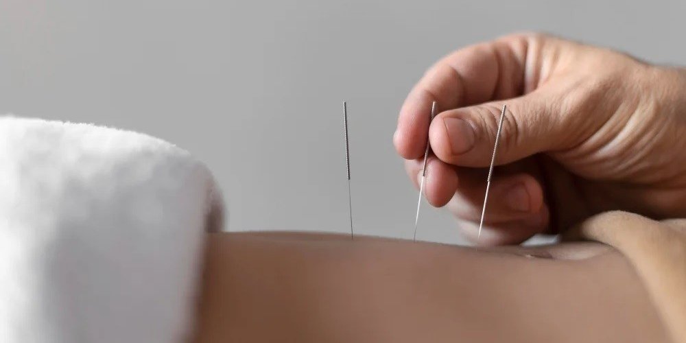 Acupuncture Promotes Natural Healing Solutions