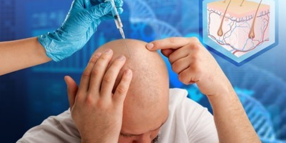 Want Hair Makes Hair Restoration Easy and Safe for You