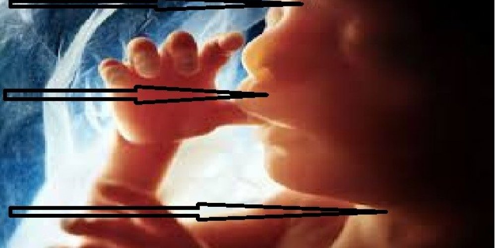 Hod za život u borbi protiv industrije pobačaja, abortusa, iliti ubijanja nerođene djece