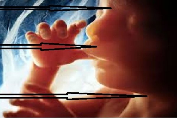 Hod za život u borbi protiv industrije pobačaja, abortusa, iliti ubijanja nerođene djece