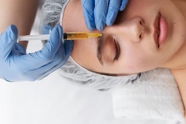 Regen RX Therapy Medical Spa Introduces Revolutionary Microneedling Prp